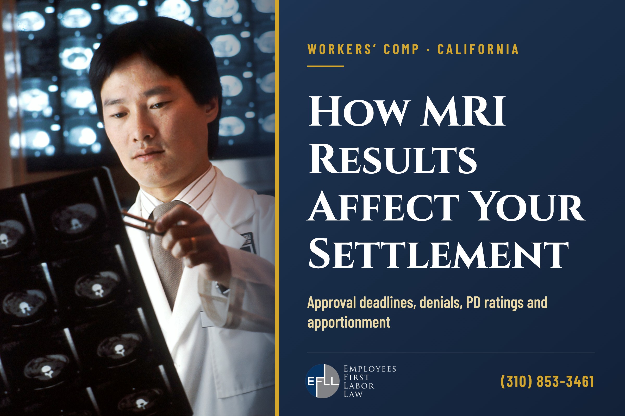 How MRI results affect your California workers’ comp settlement